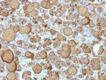 Thyroglobulin Antibody in Immunohistochemistry (Paraffin) (IHC (P))