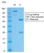 Thyroglobulin Antibody in SDS-PAGE (SDS-PAGE)