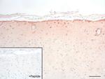 GALR1 Antibody in Immunohistochemistry (IHC)