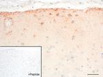 GALR1 Antibody in Immunohistochemistry (IHC)