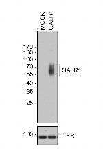 GALR1 Antibody in Western Blot (WB)