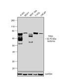 TP63 Antibody in Western Blot (WB)