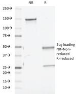 TGF-beta (Transforming Growth Factor beta) Antibody in SDS-PAGE (SDS-PAGE)