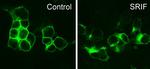 SSTR3 Antibody in Immunocytochemistry (ICC/IF)