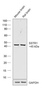 SSTR1 Antibody in Western Blot (WB)