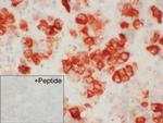 SSTR1 Antibody in Immunohistochemistry (IHC)