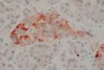 SSTR1 Antibody in Immunohistochemistry (IHC)