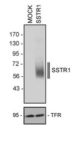 SSTR1 Antibody in Western Blot (WB)