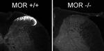 OPRM1 Antibody