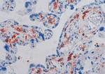 Endothelin A Receptor Antibody in Immunohistochemistry (IHC)