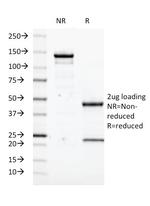 Transglutaminase II (TGM2) Antibody in SDS-PAGE (SDS-PAGE)