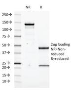 Transglutaminase II (TGM2) Antibody in SDS-PAGE (SDS-PAGE)