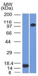 Thrombomodulin/CD141 Antibody in Western Blot (WB)