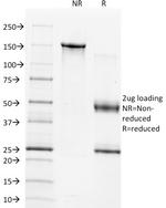 TIMP1 (Marker of Lymph Node Metastasis) Antibody in SDS-PAGE (SDS-PAGE)