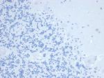 TIMP1 (Marker of Lymph Node Metastasis) Antibody in Immunohistochemistry (Paraffin) (IHC (P))