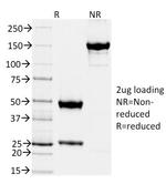 TIMP2 (Tissue Inhibitor of Metalloproteinase 2) Antibody in SDS-PAGE (SDS-PAGE)