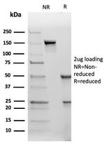 TIMP2 (Tissue Inhibitor of Metalloproteinase 2) Antibody in SDS-PAGE (SDS-PAGE)