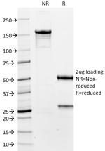 TTF-1/NKX2.1 (Thyroid and Lung Epithelial Marker) Antibody in SDS-PAGE (SDS-PAGE)