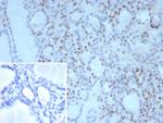 TTF-1/NKX2.1 (Thyroid and Lung Epithelial Marker) Antibody in Immunohistochemistry (Paraffin) (IHC (P))