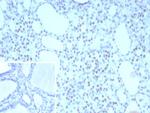 TTF-1/NKX2.1 (Thyroid and Lung Epithelial Marker) Antibody in Immunohistochemistry (Paraffin) (IHC (P))