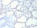 TTF-1/NKX2.1 (Thyroid and Lung Epithelial Marker) Antibody in Immunohistochemistry (Paraffin) (IHC (P))