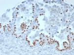 TTF-1/NKX2.1 (Thyroid and Lung Epithelial Marker) Antibody in Immunohistochemistry (Paraffin) (IHC (P))