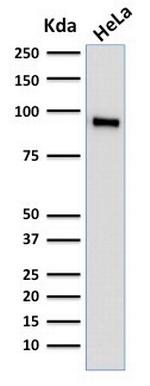 TLE1 (Synovial Sarcoma Marker) Antibody in Western Blot (WB)