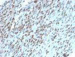 TLE1 (Synovial Sarcoma Marker) Antibody in Immunohistochemistry (Paraffin) (IHC (P))