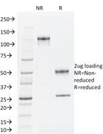 TLE1 (Synovial Sarcoma Marker) Antibody in SDS-PAGE (SDS-PAGE)