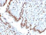 TLE1 (Synovial Sarcoma Marker) Antibody in Immunohistochemistry (Paraffin) (IHC (P))