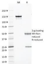 TLE1 (Synovial Sarcoma Marker) Antibody in SDS-PAGE (SDS-PAGE)