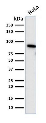 TLE1 (Synovial Sarcoma Marker) Antibody in Western Blot (WB)