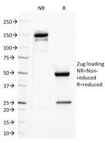 CD282 (Toll-Like Receptor 2) Antibody in SDS-PAGE (SDS-PAGE)