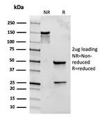 CD282 (Toll-Like Receptor 2) Antibody in SDS-PAGE (SDS-PAGE)