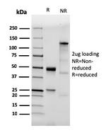 CD282 (Toll-Like Receptor 2) Antibody in SDS-PAGE (SDS-PAGE)