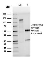 CD284 (Toll-Like Receptor 4) Antibody in SDS-PAGE (SDS-PAGE)