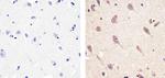 CXCL5 Antibody in Immunohistochemistry (Paraffin) (IHC (P))