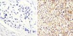 STAT3 Antibody in Immunohistochemistry (Paraffin) (IHC (P))