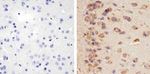 STAT3 Antibody in Immunohistochemistry (Paraffin) (IHC (P))