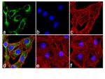 Phospho-INSR (Tyr1158) Antibody