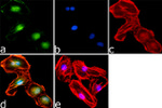 Phospho-AS160 (Thr642) Antibody in Immunocytochemistry (ICC/IF)