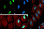 Phospho-Tau (Thr231) Antibody in Immunocytochemistry (ICC/IF)