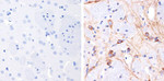 Phospho-Tau (Thr231) Antibody in Immunohistochemistry (Paraffin) (IHC (P))