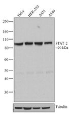 STAT2 Antibody in Western Blot (WB)