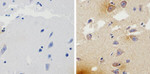 beta Amyloid Antibody in Immunohistochemistry (Paraffin) (IHC (P))