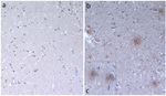 beta Amyloid Antibody in Immunohistochemistry (IHC)