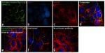 Phospho-EGFR (Tyr1148) Antibody in Immunocytochemistry (ICC/IF)