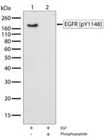 Phospho-EGFR (Tyr1148) Antibody in Western Blot (WB)