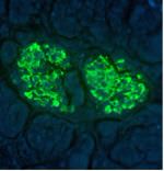 Insulin Antibody in Immunohistochemistry (IHC)