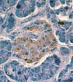 Insulin Antibody in Immunohistochemistry (IHC)